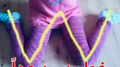 صورة أضرار جلوس الطفل على شكل حرف W وطرق العلاج