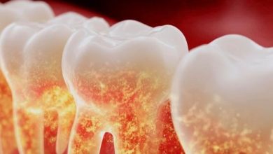 صورة هل يمكن أن تنقذ ضروس العقل حياتك؟ سر مذهل يكشفه العلم!