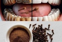 صورة بمكون بسيط أفضـل الطرق الطـبيعية لإزالة البـلاك والجير المتـراكم في الأسنا