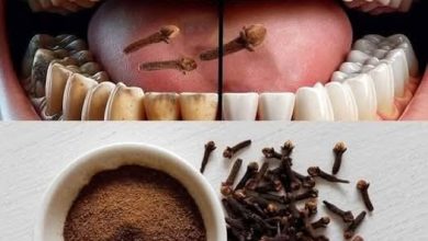 صورة بمكون بسيط أفضـل الطرق الطـبيعية  لإزالة البـلاك والجير المتـراكم في الأسنا