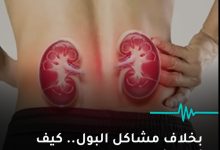 صورة بخلاف مشاكل البول- كيف أعرف أن لدي مشكلة في الكلى؟