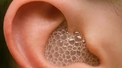 صورة تنظيف الأذن من الشمع.. أفضل الطرق الطبيعية لتنظيف الأذن بسرعة وبأمان